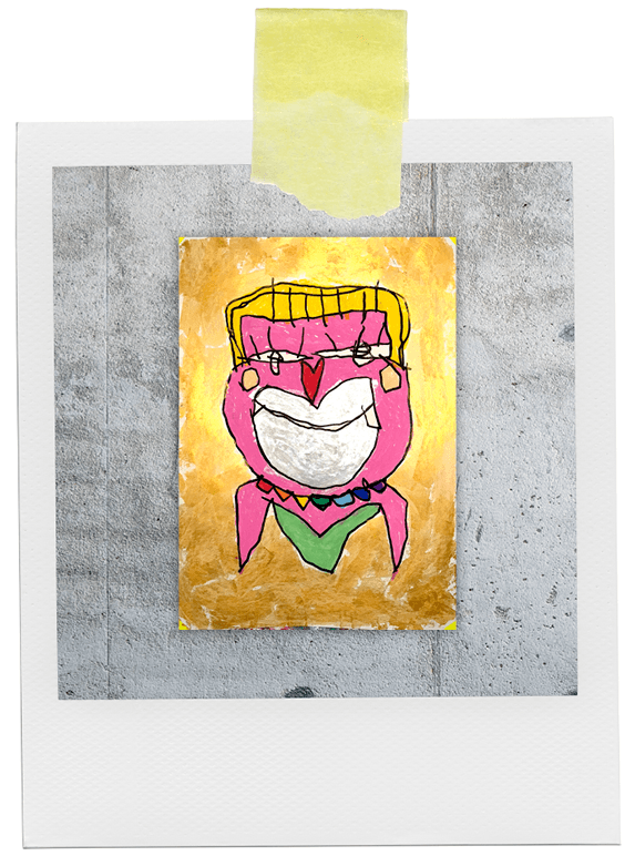 i guess i need some more botox